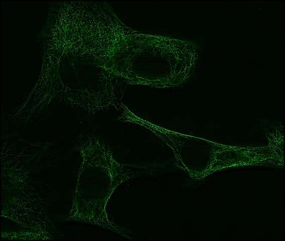 aurox confocal microscope SRRF_Max_Projection_NIH3T3_Mouse_fibroblast.jpg
